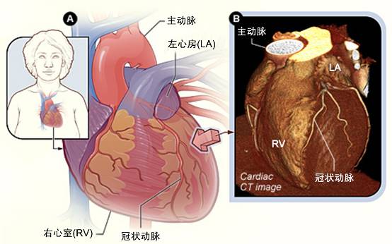 冠心病需要做哪些檢查？(圖2)