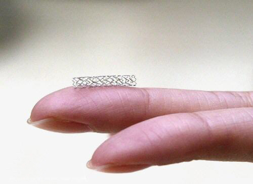 什么是金屬裸支架？(圖1)