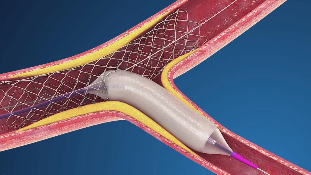 BEYOND(圖1) BEYOND(圖1)