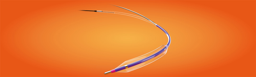 勝蠔?Vwin?顱內(nèi)球囊擴(kuò)張導(dǎo)管(圖1) 勝蠔?Vwin?顱內(nèi)球囊擴(kuò)張導(dǎo)管(圖1)